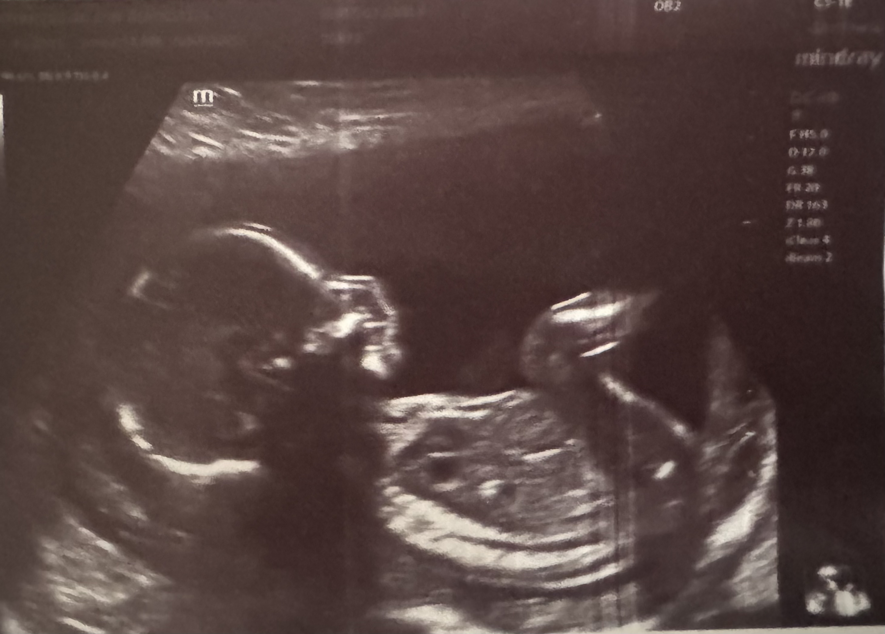 Owen Ultrasound